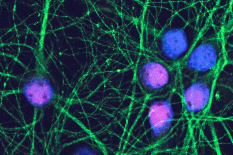 The reddish-blue mouse neurons in this image have reentered the cell cycle after exposure to amyloid beta oligomers, and thus are primed for death.