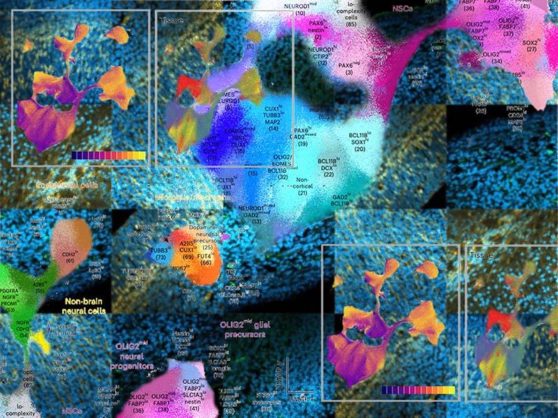 Brain Atlas
